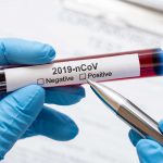 Mostra de sang extreta per detectar el virus SARS-CoV-2